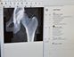 Preview of Operator view of hip during DXA scan