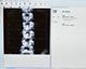 Preview of Operator frontal view of spine during DXA scan